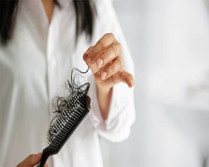 100 pc rise in hair loss complaints among Covid patients at Delhi hospital