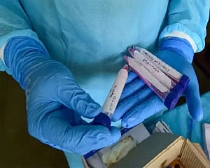 Delhi reports 17 COVID-19 cases; positivity rate 0.04 pc