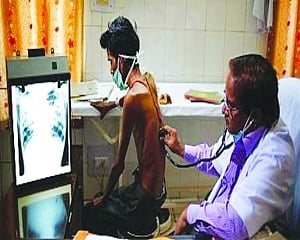 India’s collective responsibility to eradicate TB