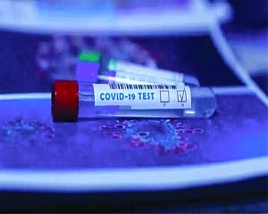 RT-PCR test in Delhi-NCR suffers as lab staff fall sick