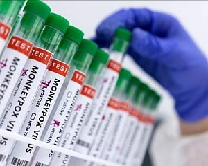 African woman with recent travel history to Nigeria Delhi's 5th monkeypox case