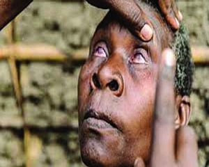 Trachoma causing blindness in adults remain a concern: AIIMS  conducts survey