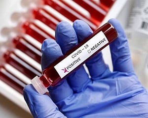 India adds 21,411 COVID-19 cases, 67 deaths