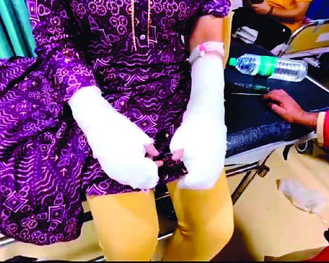 Acid attack probe sees arrest of victim’s father