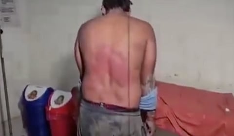 The person who was allegedly beaten in Jhansi’s Samthar area. Image source: News 30 Express