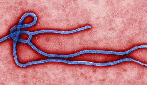 Representational image. File photo (2011). Ebola virus particles seen under an electron microscope. Photo: CDC/Cynthia Goldsmith (public domain).