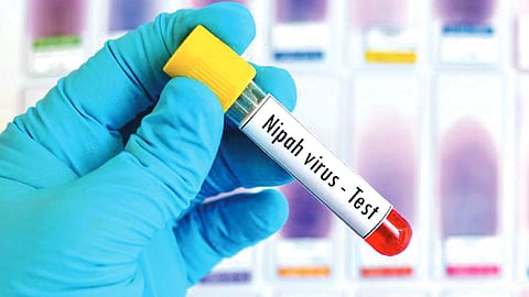 South Africa urges calm after Nipah cases reported in India