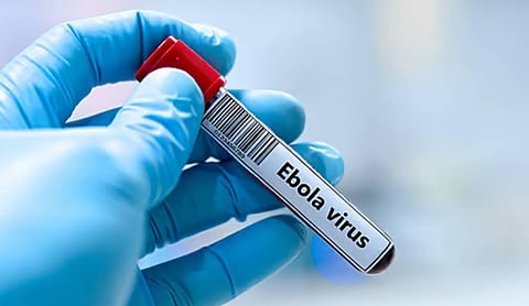 Uganda National in Bengaluru tests negative for Ebola after isolation, Officials confirm