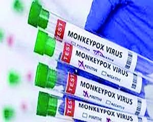 1st desi RT-PCR kit for monkeypox launched