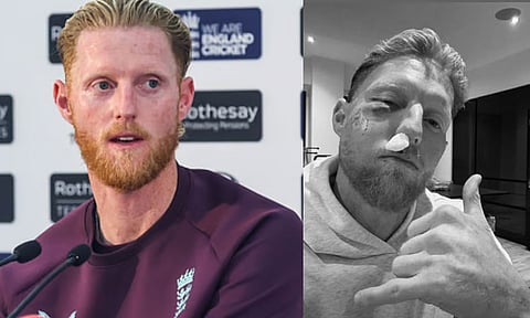 கண்ணில் காயம்… இன்ஸ்டாவில் ஜோக்! - வைரலாகும் பென் ஸ்டோக்ஸின் புகைப்படம்