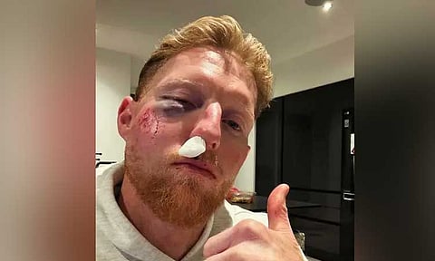 பந்து தாக்கியதில் ஸ்டோக்ஸ் பலத்த காயம்: ரசிகர்கள் அதிர்ச்சி 
