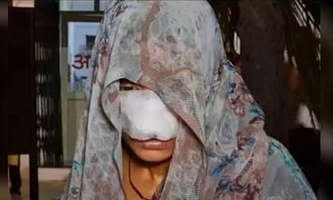 குடும்ப பிரச்சினையில் மனைவியின் மூக்கை கடித்து துப்பிய இளைஞர் - அதிர்ச்சி சம்பவம்