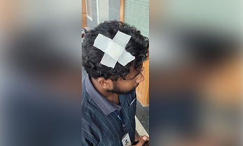 பெருங்களத்தூர்-தாம்பரம் இடையே மின்சார ரெயில் மீது கல்வீச்சு; பயணிக்கு தலையில் காயம்