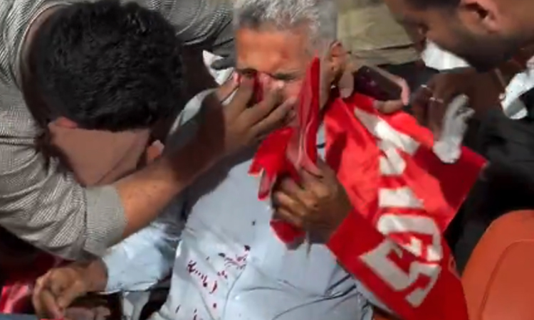 பிரியன்ஷி ஆர்யா அடித்த பந்து தாக்கி ரசிகர் பலத்த காயம்