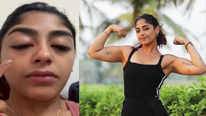 முகம் வீங்கி, பல் உடைக்கப்பட்டு... அடையாளமே தெரியாத அளவுக்கு மாறிய மாடல் அழகி - வீடியோ வைரல்