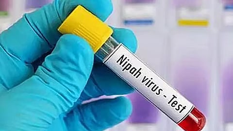 கேரளாவில் 3 பேருக்கு நிபா வைரஸ் பாதிப்பு உறுதி