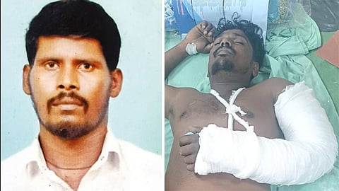 நெல்லை இரட்டை கொலை வழக்கு: கைது செய்யப்பட்ட மேலும் ஒருவருக்கு எலும்பு முறிவு