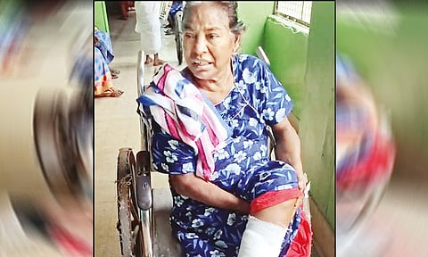 68 வயது  மூதாட்டியை எலி கடித்த சம்பவம்: தமிழ்நாடு மருத்துவ கல்வி இயக்குனரகம் விளக்கம்