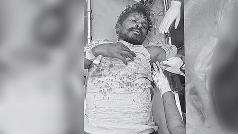 தாராபுரம்: தகராறில் அரிவாள் வெட்டில் துண்டான கையுடன் ஆஸ்பத்திரிக்கு வந்த தொழிலாளி
