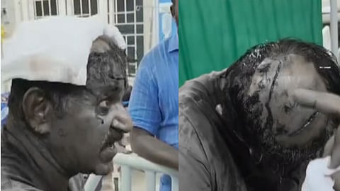 ஹோட்டல் உரிமையாளருக்கு அரிவாள் வெட்டு
