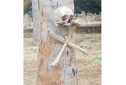 தென்னை மரங்களில் மண்டை ஓடு, எலும்புகள் கட்டப்பட்டிருந்ததால் பரபரப்பு