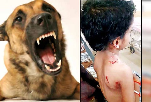 பழனியில் தெருநாய்கள் கடித்து குதறியதில் மாணவி காயம்