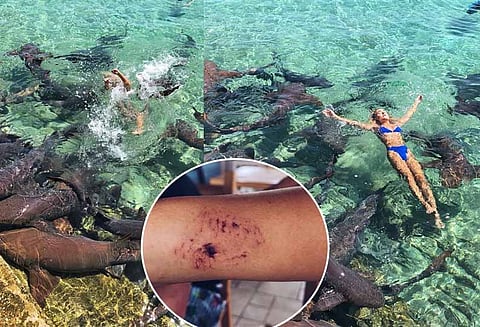 சுறாக்கள் மத்தியில் புகைப்படம் எடுத்த போது மாடல் அழகிக்கு நேர்ந்த கதி