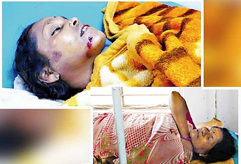 யானைகள் தாக்கி தம்பதி உள்பட 3 பேர் காயம்