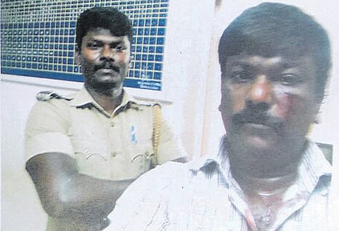 வக்கீலை தாக்கி செல்பி சப்-இன்ஸ்பெக்டரின் செயலை மன்னிக்க முடியாது ஐகோர்ட்டு நீதிபதிகள் எச்சரிக்கை