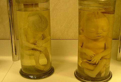 ஜப்பானில் வீட்டின் தரைக்கு அடியில் கண்ணாடி புட்டிகளுக்குள் குழந்தைகளின் உடல்கள் கண்டெடுப்பு