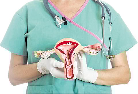 பெண்களை மிரட்டும் கர்ப்பப்பை வாய் புற்றுநோய்