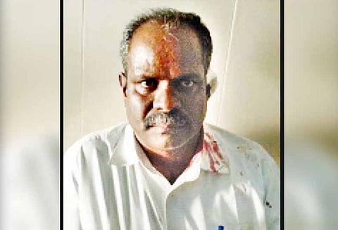 டாஸ்மாக் மேற்பார்வையாளரை அரிவாளால் வெட்டி ரூ.5 லட்சம் கொள்ளை