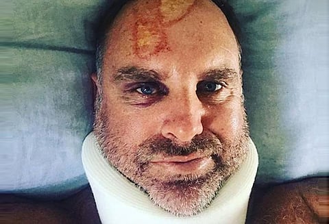 அலைச்சறுக்கு விளையாட்டில் ஈடுபட்ட போது விபத்தில் சிக்கினார், ஹைடன்