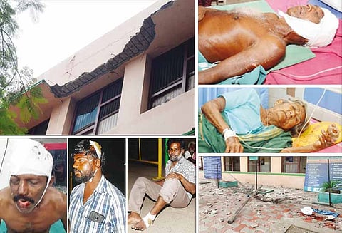 ஈரோடு அரசு ஆஸ்பத்திரியில் ‘சிலாப்’ இடிந்து விழுந்தது : 5 பேர் படுகாயம்