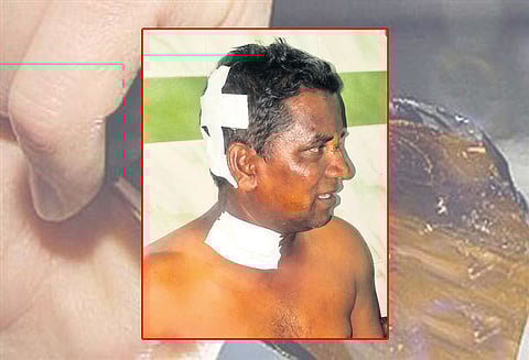 திருப்போரூரில் முன்விரோதத்தில் பீர்பாட்டிலால் தாக்குதல் 4 பேருக்கு வலைவீச்சு