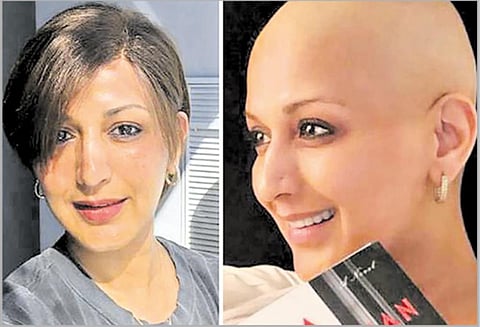 புதிய ‘விக்’கில் சோனாலி பிந்த்ரே