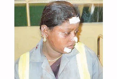 கறம்பக்குடியில் குப்பையில் கிடந்த நாட்டு வெடி வெடித்து துப்புரவு பெண் தொழிலாளி படுகாயம்