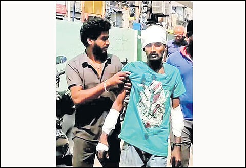 பூந்தமல்லி அருகே மெக்கானிக் உள்பட 2 பேருக்கு அரிவாள் வெட்டு தப்பி ஓடிய மர்ம கும்பலுக்கு வலைவீச்சு