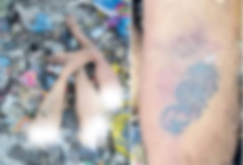 குப்பை கிடங்கில் கிடந்த கை, கால்களுக்கு உரிய பெண்ணின் அடையாளம் தெரிந்தது