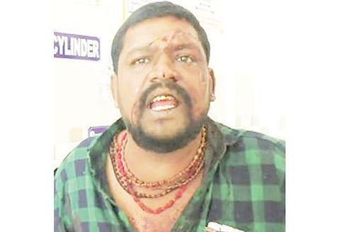 காரை மறித்து வக்கீல் வெட்டிக்கொலை; அண்ணன் உள்பட 2 பேர் படுகாயம் மர்ம கும்பல் வெறிச்செயல்