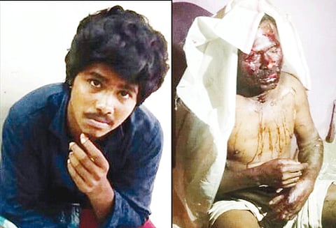 வீட்டில் தூங்கிக்கொண்டிருந்த தந்தை மீது மண்எண்ணெய் ஊற்றி உயிரோடு எரிப்பு நடிகர் அஜித் படம் பார்க்க பணம் தராததால் மகன் வெறிச்செயல்