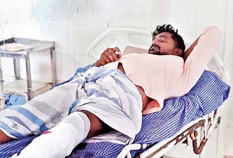 தஞ்சையில், போலீசார் விரட்டி சென்றபோது பாலத்தில் இருந்து குதித்த பிரபல ரவுடியின் கால் முறிந்தது - ஆஸ்பத்திரியில் அனுமதி