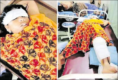 கொள்ளையர்களுடன் போராடியபோது ஓடும் ரெயிலில் இருந்து விழுந்து பெண் படுகாயம்