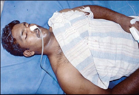 சேலத்தில் பரபரப்பு சிறப்பு காவல்படை போலீஸ்காரர் தற்கொலை முயற்சி