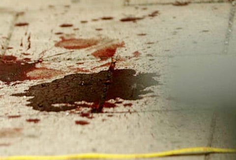 மதுரை அருகே கொலை வழக்கில் துப்புதுலங்கியது: சொத்துக்காக வாலிபரை கழுத்தை அறுத்து கொன்ற 76 வயது பாட்டி, பரபரப்பு தகவல்