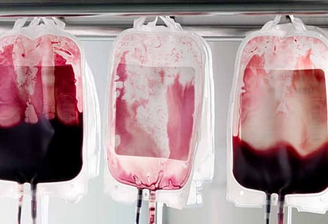 இளமையை மீட்க இளைஞர்களின் ரத்தத்தை முதியவர்களுக்கு செலுத்தும் புதிய சிகிச்சை