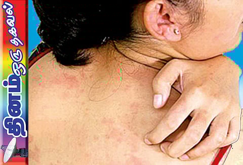 ‘அரிப்பு’ என்பது ஆரோக்கியமான எச்சரிக்கை