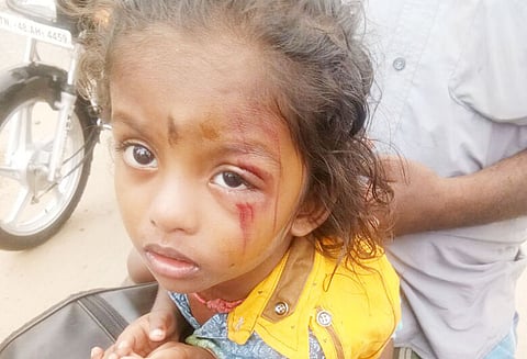 தந்தையுடன் மோட்டார் சைக்கிளில் சென்ற 2 வயது சிறுவன் மீது கொடூர தாக்குதல்