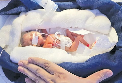 உடல் தேறிய 400 கிராம் குழந்தை