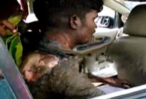 சீட் பெல்ட் அணியாமல் வந்த வாலிபரை போலீசார் தாக்கியதால் தீக்குளித்தார்